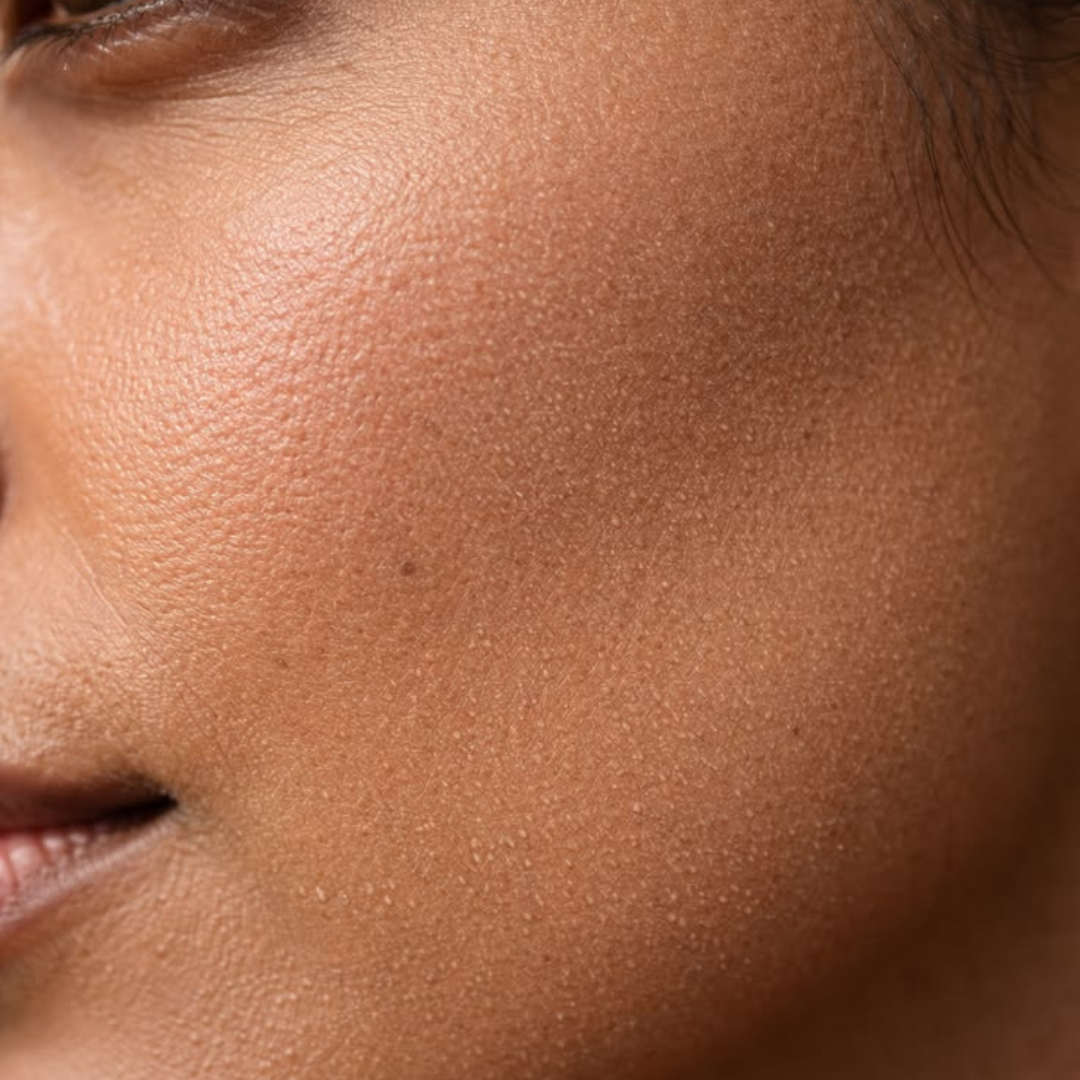Combination Skin Explained: How to balance oily and dry areas