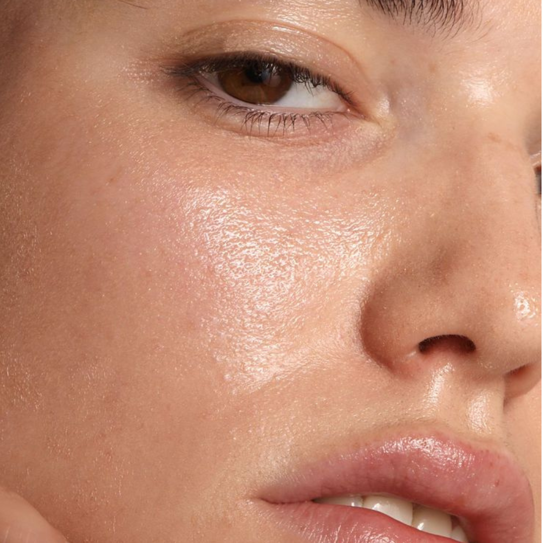 Textured Skin: What Causes Uneven Skin Texture and How Korean Skincare Can Help