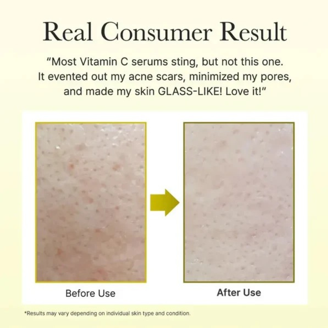 Vitamin C Booster Shot Mini
