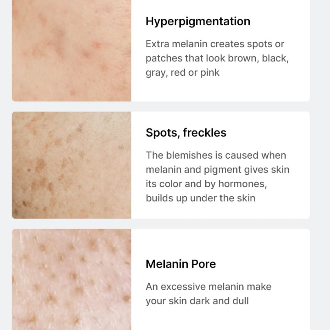 Pore + Dark Spot Brightening Kit