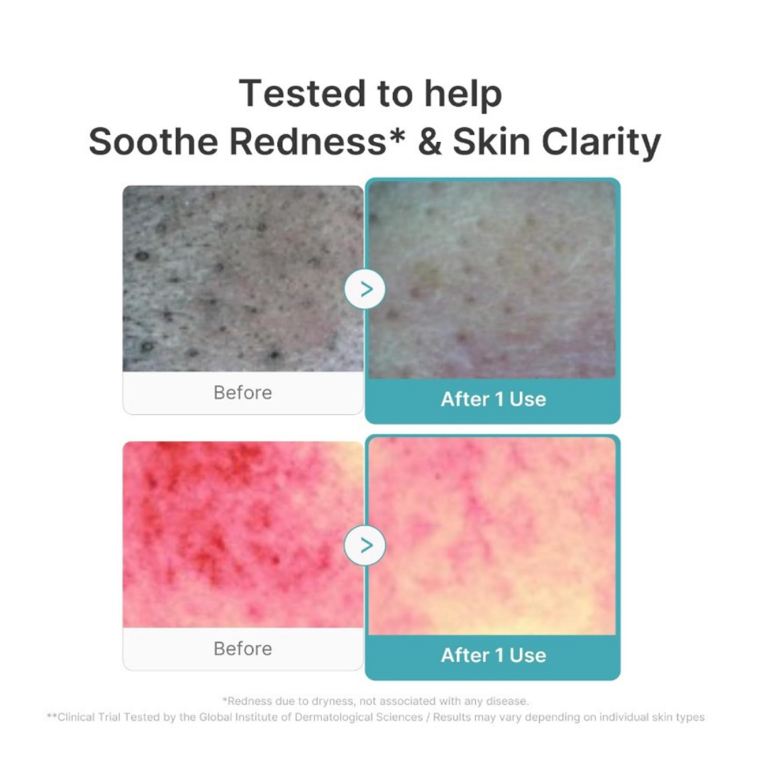 Azelaic Acid Capsule Cleansing Foam