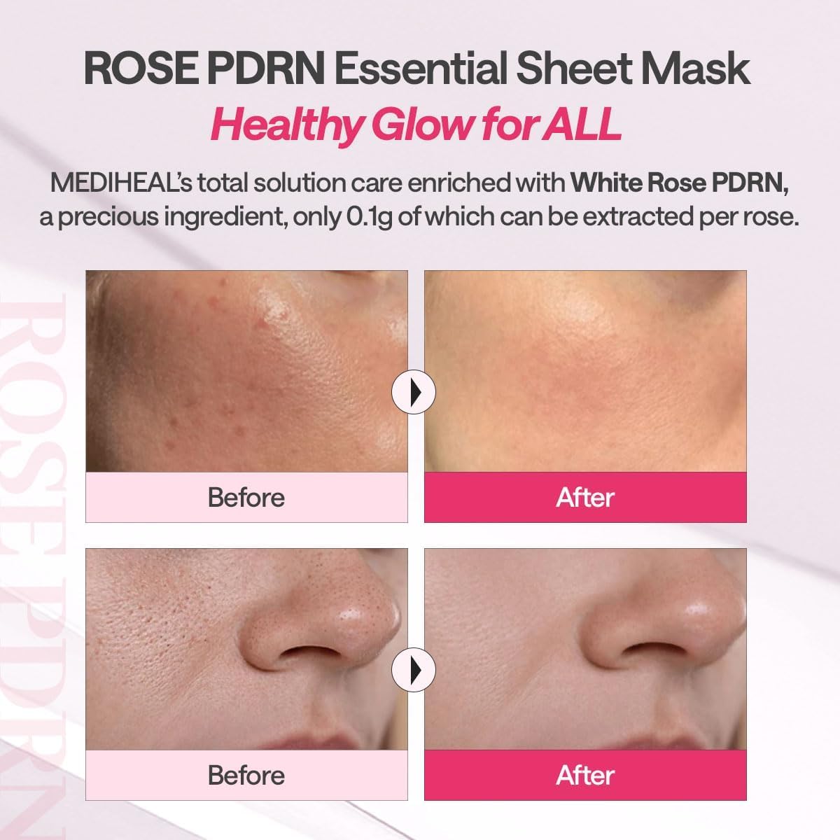 Rose PDRN Essential Mask Healthy Glow