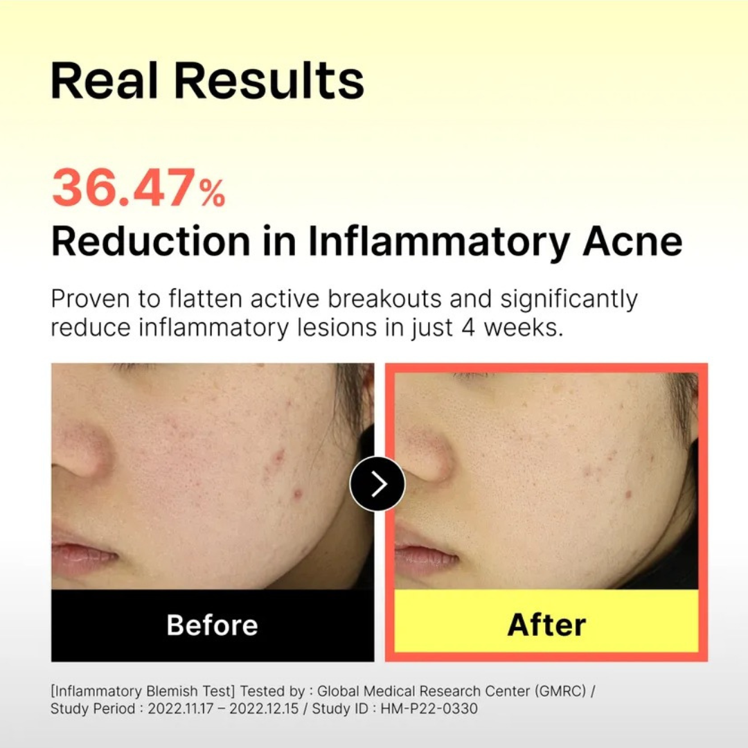 131 Pore Clearing Serum