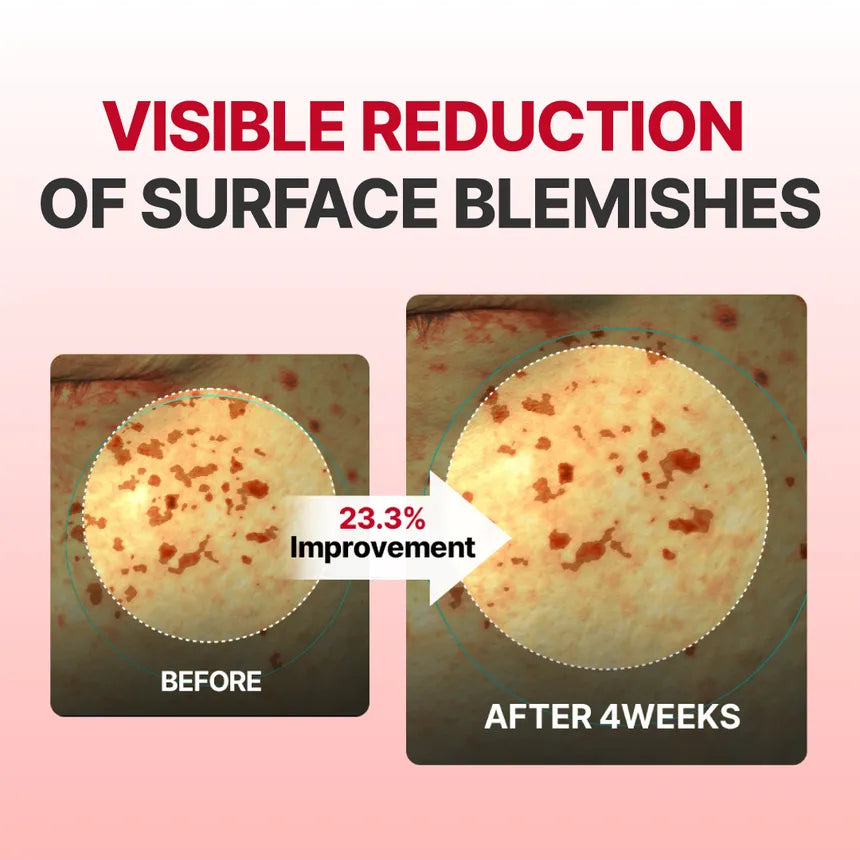 Madeca Mela Capture Ampoule Capsule Cream